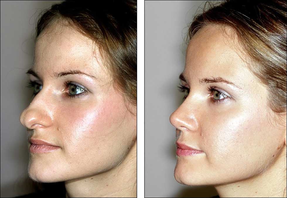 برنامه بازاریابی و سبک زندگی